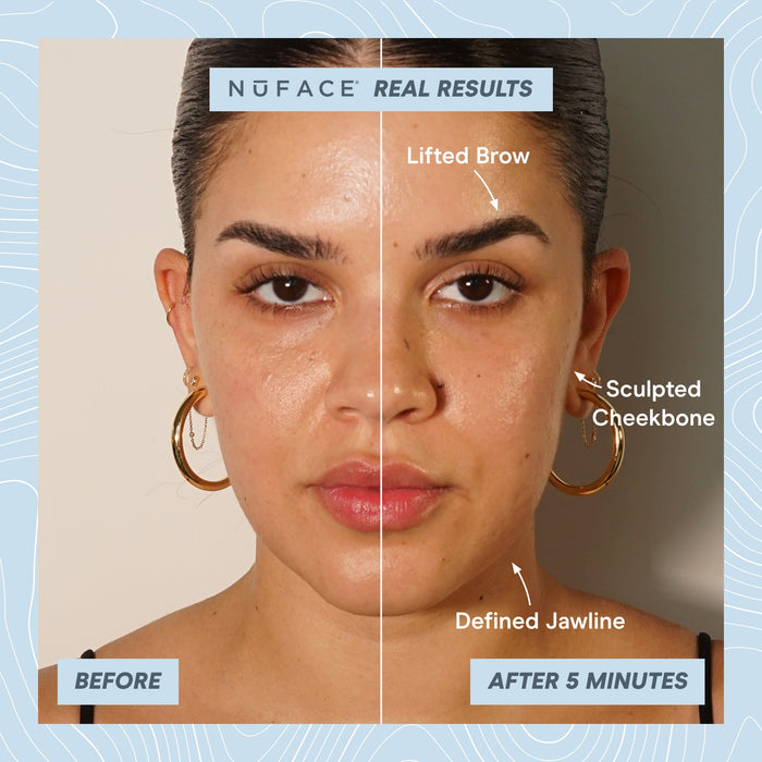 NuFACE TRINITY+ PRO Starter Kit