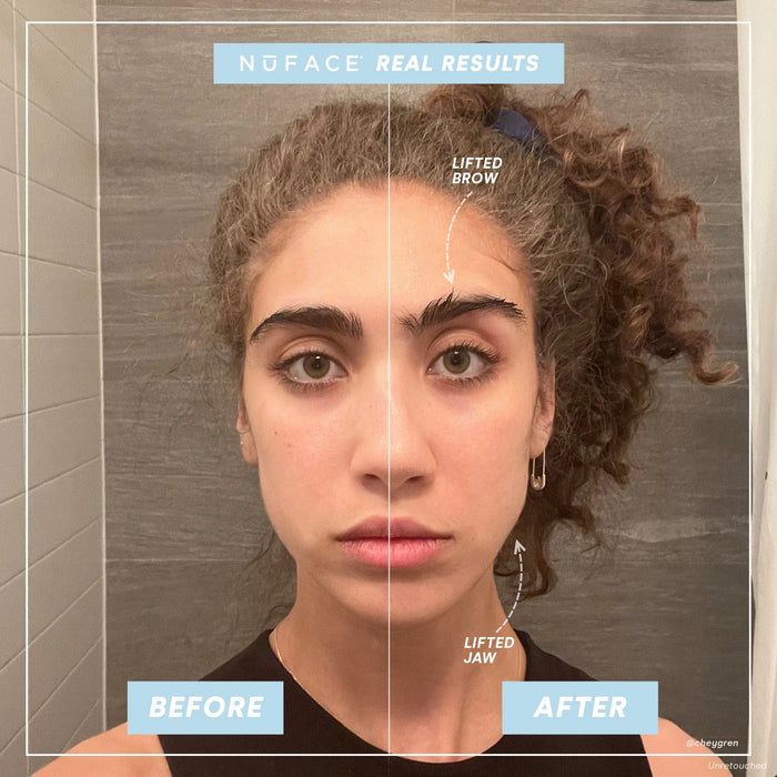 NuFACE Trinity Lip & Eye Enhancer Attachment