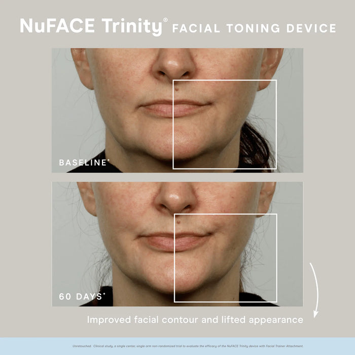 NuFACE Trinity Wrinkle Reducer Attachment (TWR)